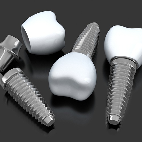 three dental implants