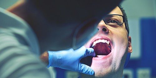 Dentist checking man's tongue