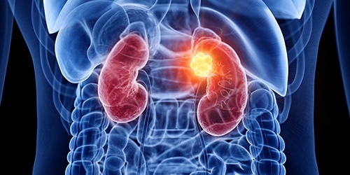 illustration of red kidney