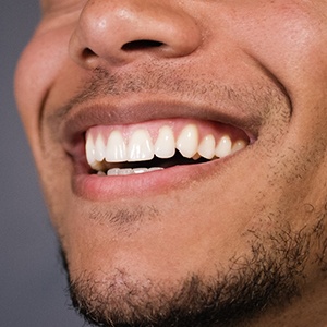close up of a man’s smile after veneers in Camp Hill