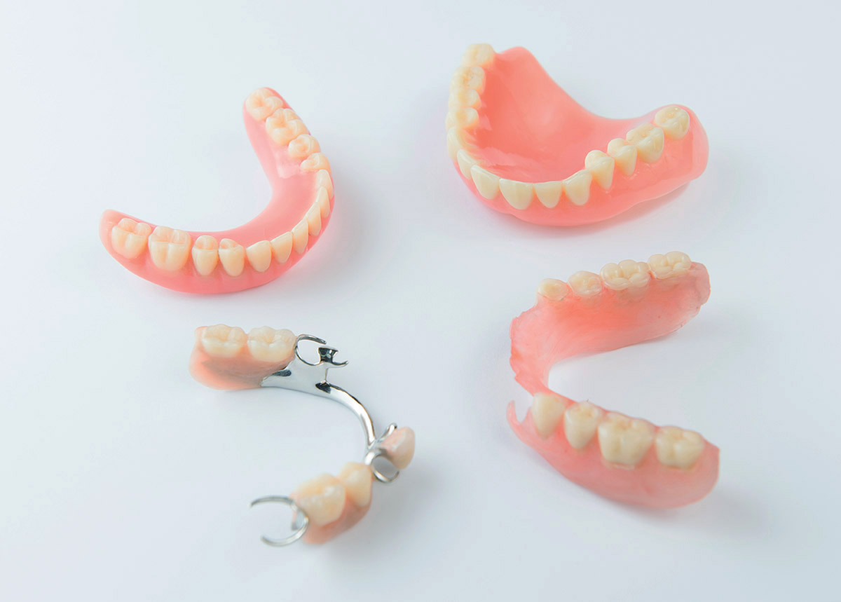 Discover Which Type of Dentures is Right for You